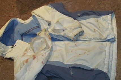 This is the blood-stained jacket belonging to Sarah James of Summerland. The blood and tears in the fabric came from a fight with three hungry coyotes gunning for James's dog.
