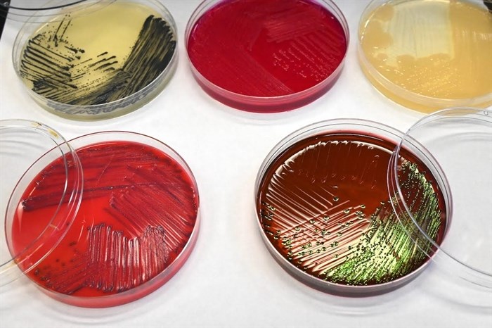 Bacteria samples, such as E. coli, listeria and salmonella, shimmering in agar media. You can look — but don’t touch!