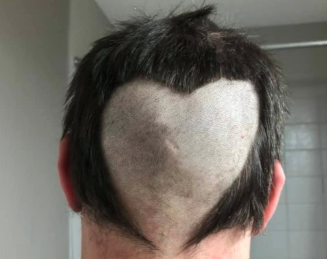 This man let his fiancee show support for health care workers with this cut.