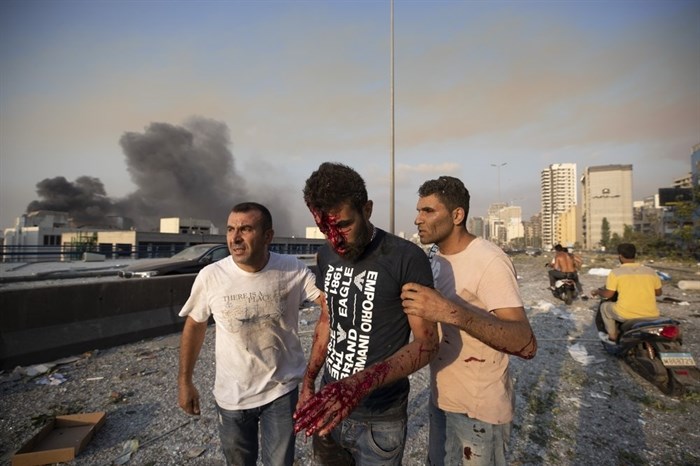 People help a man wounded in a massive explosion in Beirut, Lebanon, Tuesday, Aug. 4, 2020. Massive explosions rocked downtown Beirut on Tuesday, flattening much of the port, damaging buildings and blowing out windows and doors as a giant mushroom cloud rose above the capital. Witnesses saw many people injured by flying glass and debris. 
