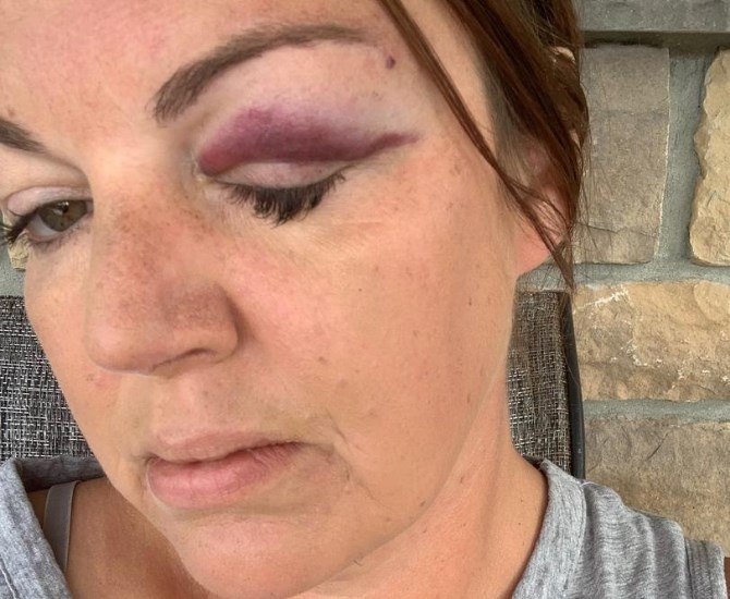 Jenn Lamont said she was tripped and had rocks thrown at her by a group of teens August 9.