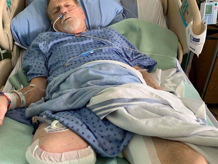 Barry Powers is recovering from an above-the-knee amputation at Royal Inland Hospital